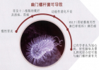 幽門螺桿菌檢測(cè)原理：13C尿素呼氣檢測(cè)的優(yōu)點(diǎn)與應(yīng)用