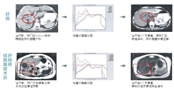 熱療系統(tǒng)
