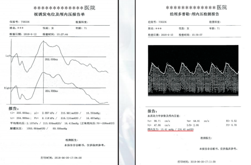 顱內(nèi)壓無創(chuàng)綜合檢測分析儀