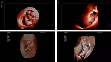 飛利浦彩色超聲診斷系統(tǒng)Affiniti30 飛利浦彩色超聲診斷系統(tǒng)Affiniti30