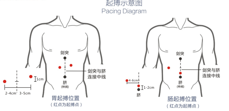 胃腸動(dòng)力治療儀
