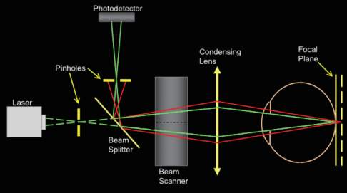 血管造影系統(tǒng)