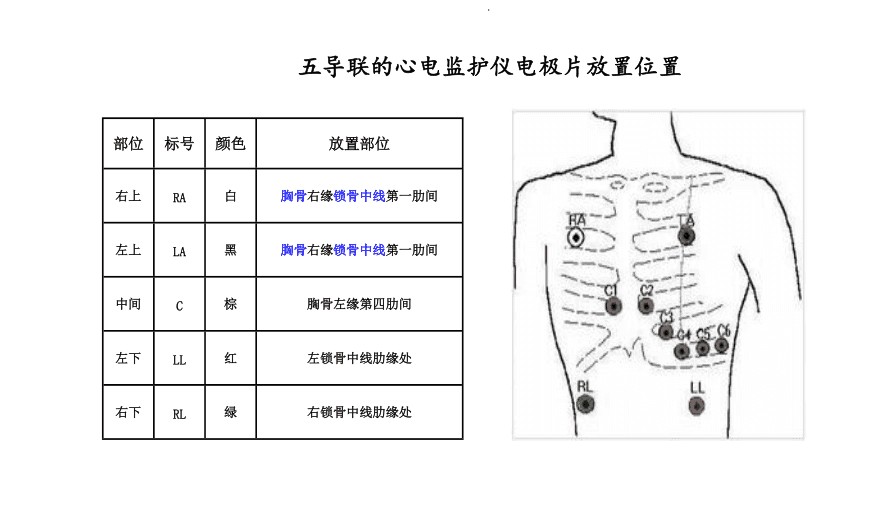 心電監(jiān)護.jpg