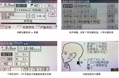 吞咽言語障礙