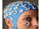 EEG-fMRI: 腦功能評估的重要交叉技術(shù)