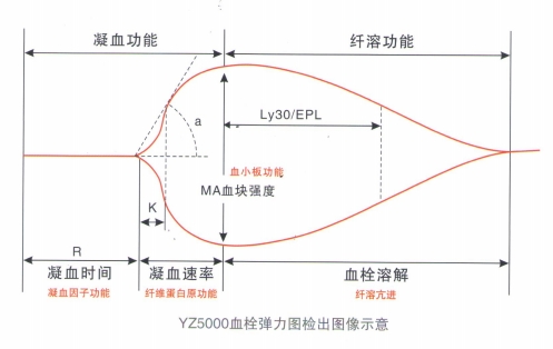血栓彈力圖檢出圖像