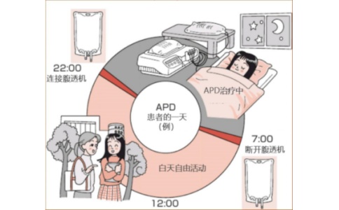 腹膜透析機