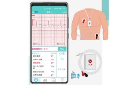 心狗動態(tài)心電圖系統(tǒng)HWD系列