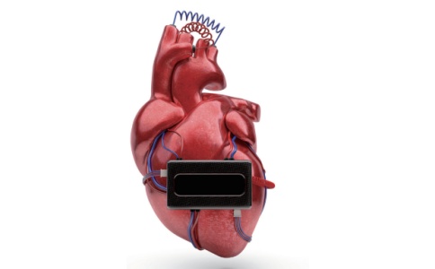 羅氏心臟標(biāo)志物檢測(cè)儀cobas h 232