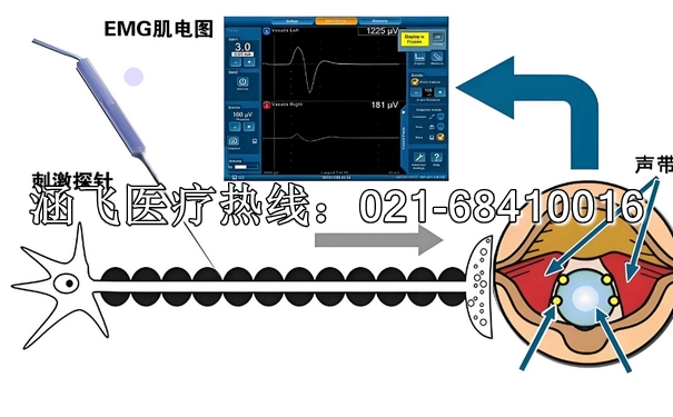 喉返神經(jīng)監(jiān)測(cè)儀3.jpg